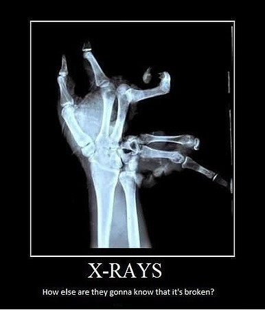 x-rays-demotivational