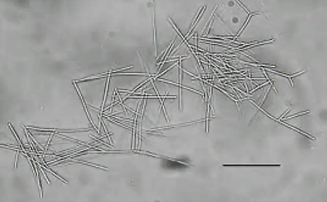 Megabacteriosis