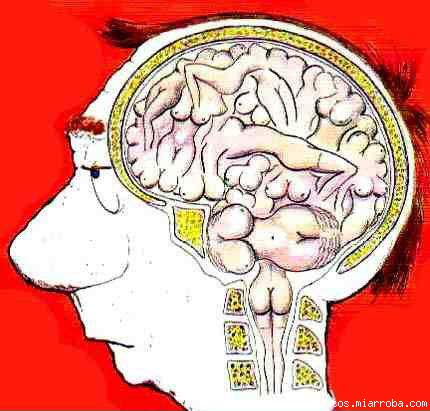 cerebro masculino