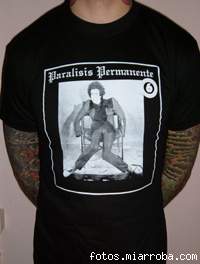 Paralisis Permanente Paralisis Permanente