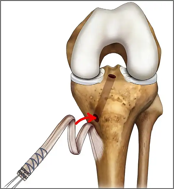 fig1