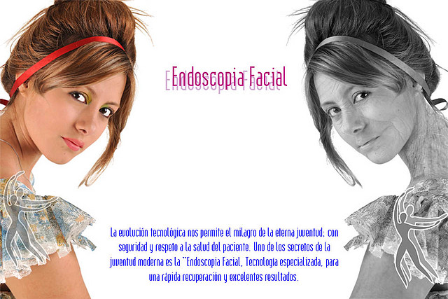 Endoscopia facial