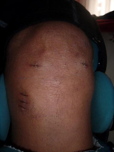 rodilla 001 rodilla 001