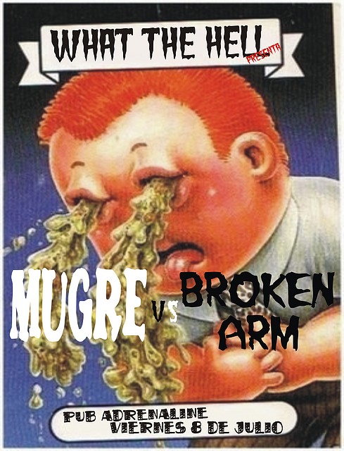 Mugre Broken Arm