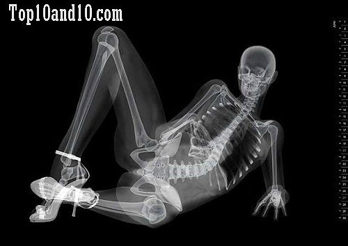 Sexy-models-under-X-ray-9