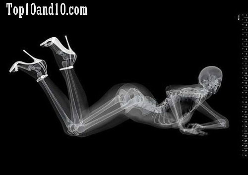 Sexy-models-under-X-ray-7