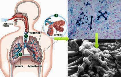 AMIANTO%20EN%20CUERPO