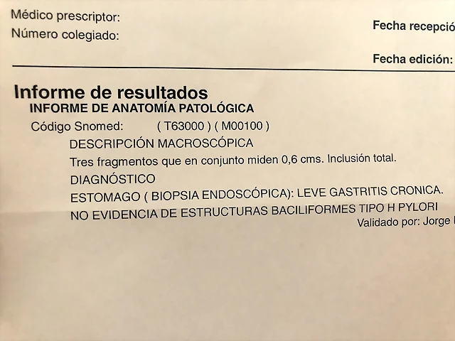 AA4BDBB2-8254-4E5D-AB79-7D5771FBF3E6