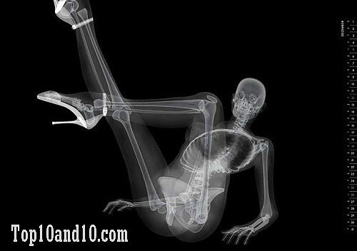 Sexy-models-under-X-ray-4