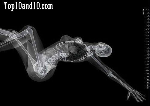 Sexy-models-under-X-ray-5