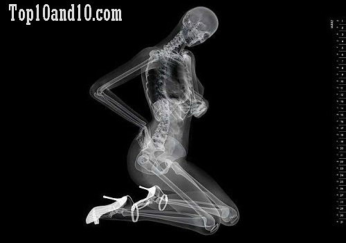 Sexy-models-under-X-ray-6