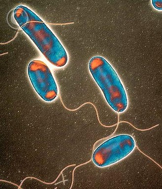 Ozono21 Legionella pneumophila