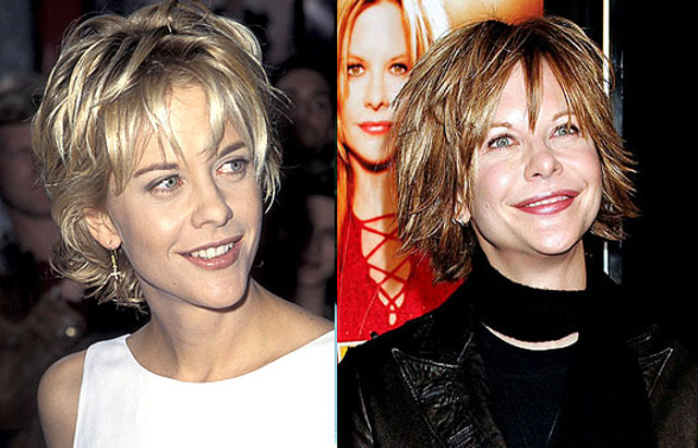 Meg-Ryan-Before-and-After-Plastic-Surgery