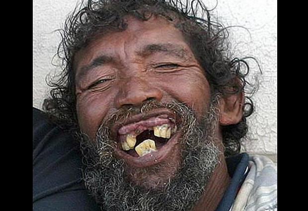 feo-3