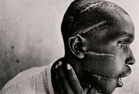 1994 Un hombre hutu mutilado por las milicias hutus, sospechoso de simpatizar con los rebeldes tutsis, en Ruanda.