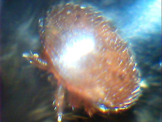 Varroa viva