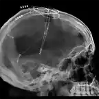 skulldiode3d-2