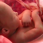 ABORTO-NI?O