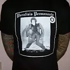 Paralisis Permanente