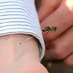 abeja-picacadura