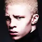 albino-665