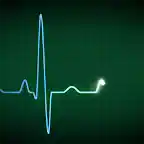 Heartbeat