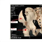 Pelvis II