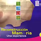 Reconstrucción mamaria