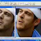 delpo (1)