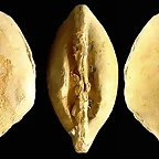 16-Callista