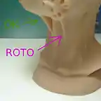 roto_cuello