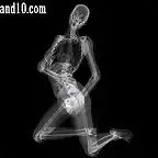 Sexy-models-under-X-ray-3