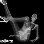 Sexy-models-under-X-ray-4