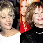 Meg-Ryan-Before-and-After-Plastic-Surgery