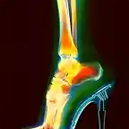 womenheels