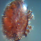 varroa vista al microscopio