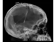 skulldiode3d-2