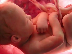 ABORTO-NI?O