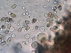 Hebeloma-mesophaeum12._arguis_esporas