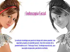 Endoscopia facial