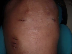 rodilla 001 rodilla 001