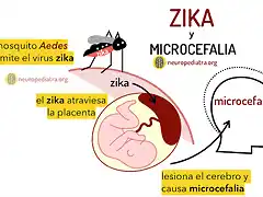 zika-y-microcefalia