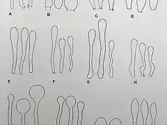 formas-de-los-queilocistidios-en-Hebeloma-1