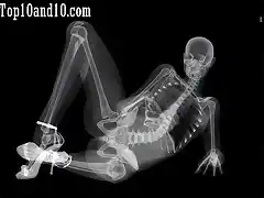 Sexy-models-under-X-ray-9