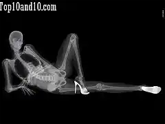 Sexy-models-under-X-ray-12