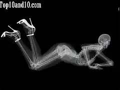 Sexy-models-under-X-ray-7