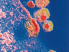 virus_infectando_una_celula virus_infectando_una_celula