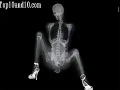 Sexy-models-under-X-ray-1