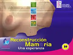 Reconstrucción mamaria