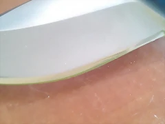 37